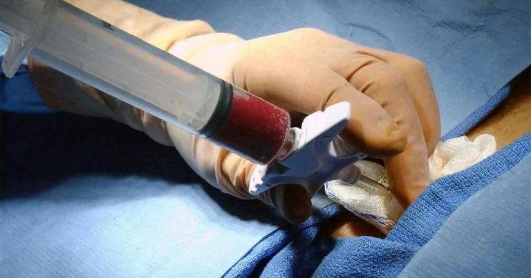 Terapias inovadoras no HC impulsionam avanço nas técnicas de transplante de medula óssea